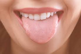 Understanding Scalloped Tongue and Its Common Signs
